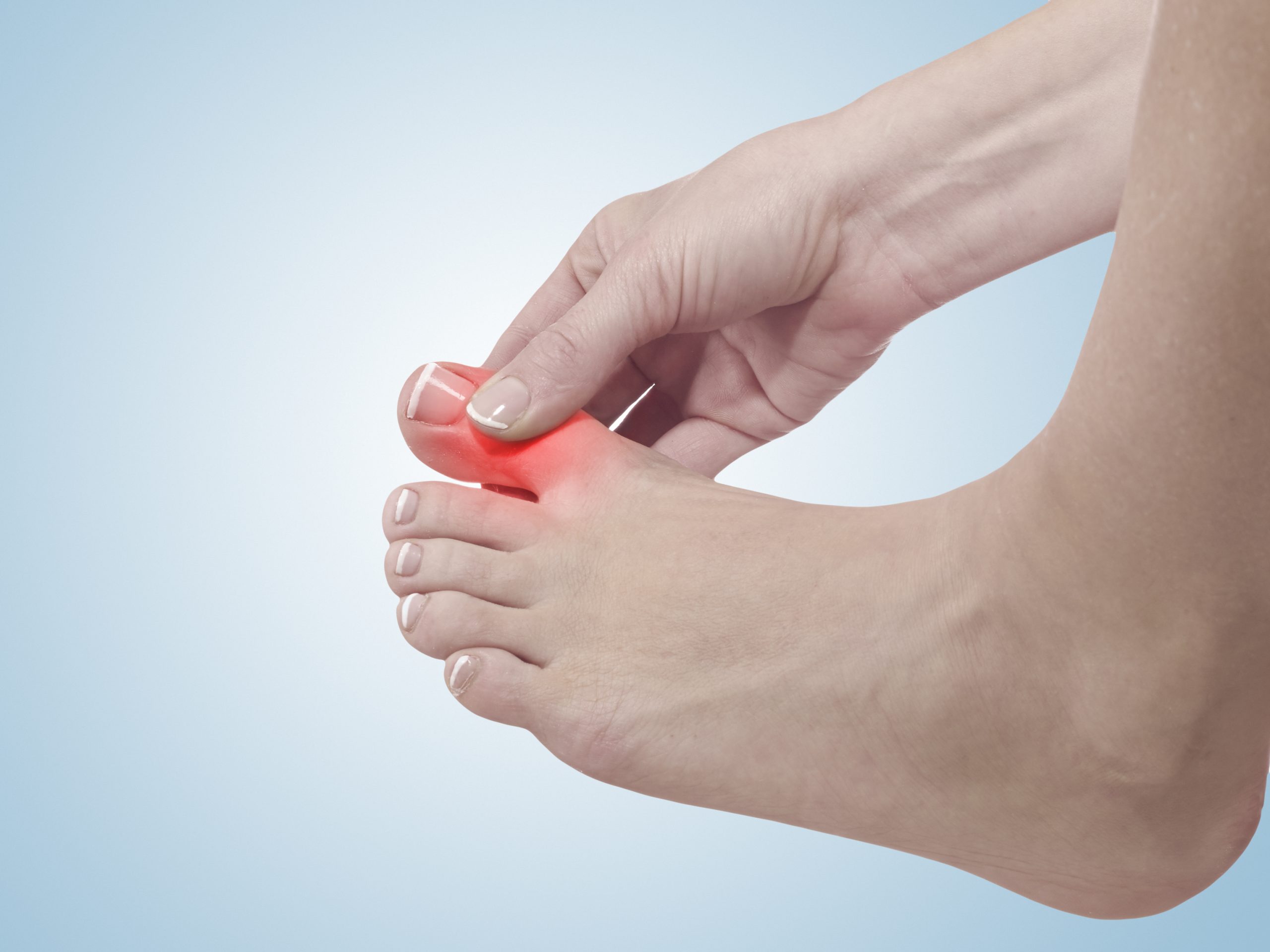 What Causes a Black Toenail Should You Be Worried  UFAI Blog